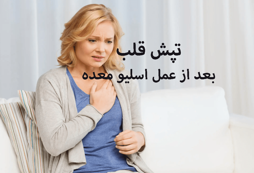 تپش قلب بعد از عمل اسلیو معده