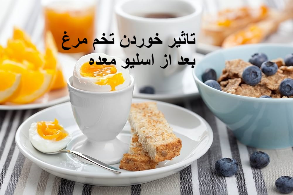 تاثیر خوردن تخم مرغ بعد از اسلیو معده